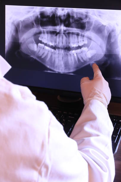 Best Emergency Tooth Extraction in Auberry, CA