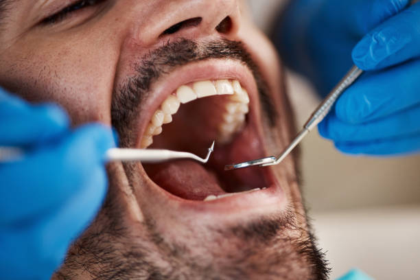 Best Emergency Dental Care for Broken or Chipped Teeth in Auberry, CA