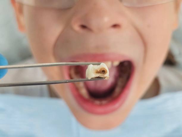Best Pediatric Emergency Dentist in Auberry, CA